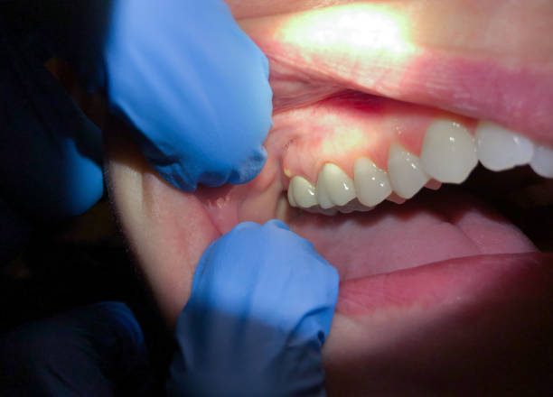 Best Walk-In Emergency Dentist in Millington, TN