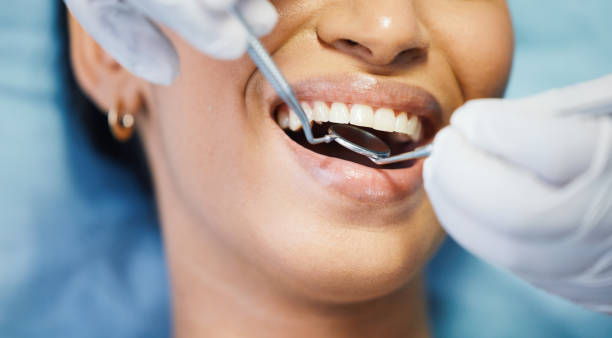 Best Emergency Broken Tooth Repair in Millington, TN